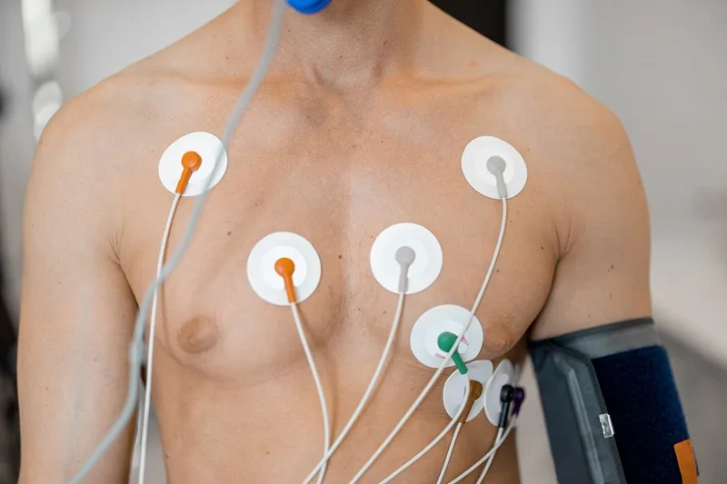 Holter de 24 horas